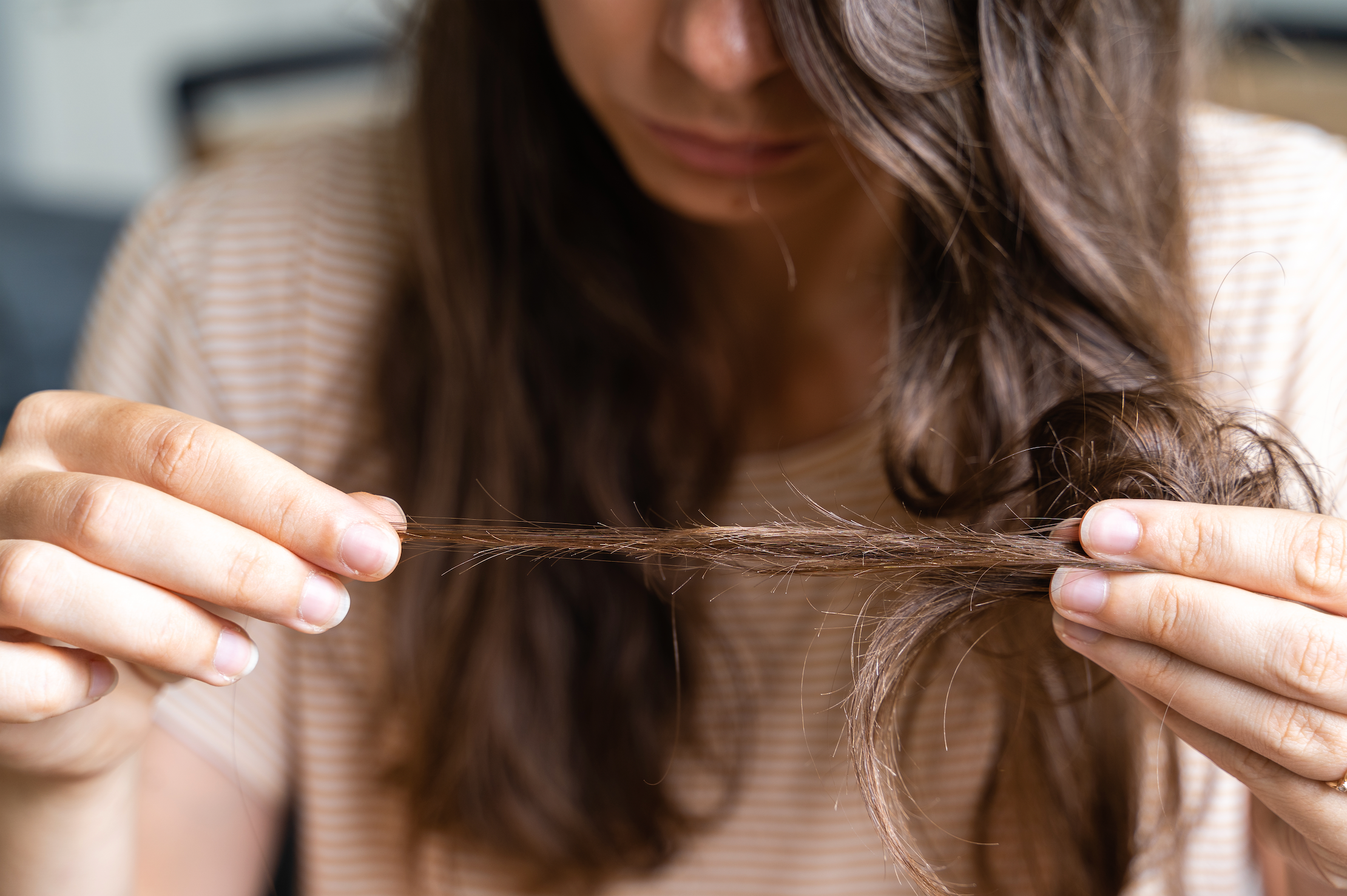 Haarausfall und seine zahlreichen Ursachen